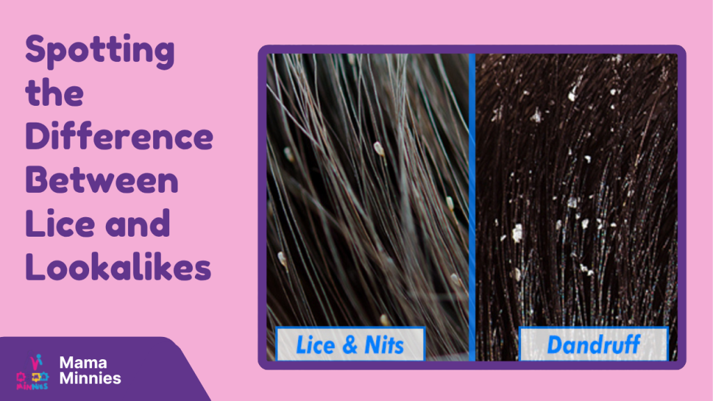 Spotting the Difference Between Lice and Lookalikes