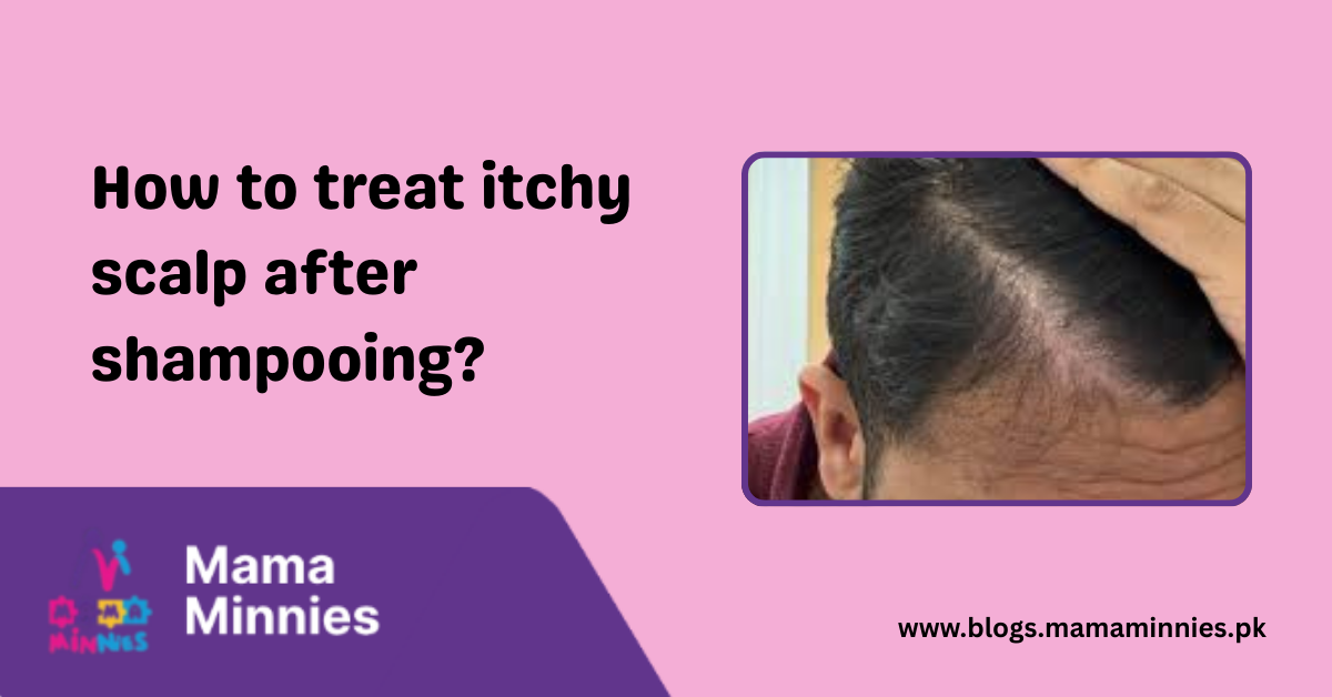 How to treat itchy scalp after shampooing